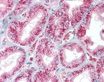 CAT Antibody