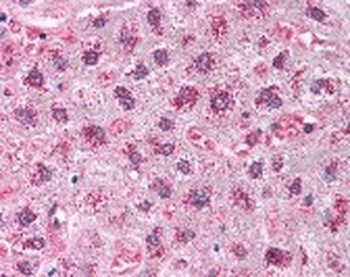 CAT Antibody