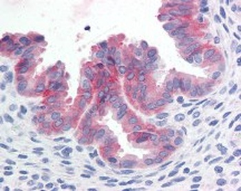 MET Antibody