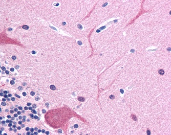 TUBB3 Antibody