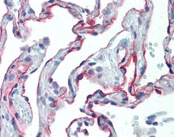 ICAM1 Antibody [15.2]