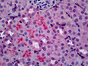 C5AR1 Antibody