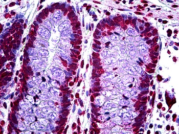 CDKN2A Antibody