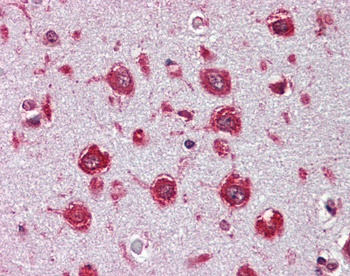 ITIH4 Antibody