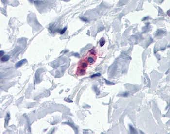 FCER1A Antibody
