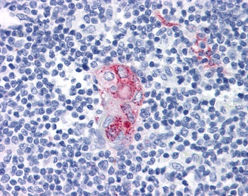 CD1D Antibody