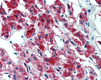 IL23A Antibody