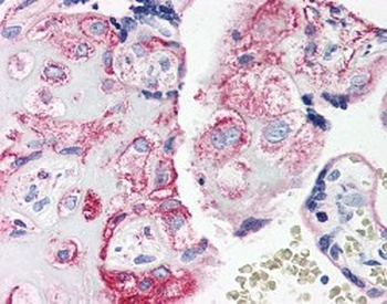 C5AR1 Antibody