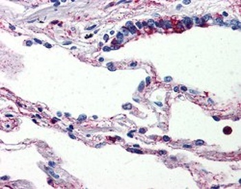 C5AR1 Antibody