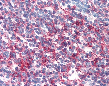 FAS Antibody [LT95]