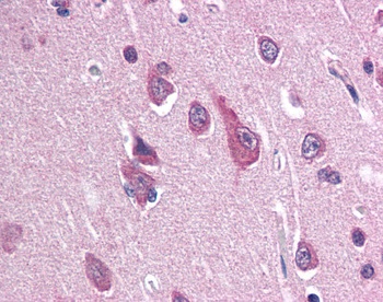 SCN2B Antibody
