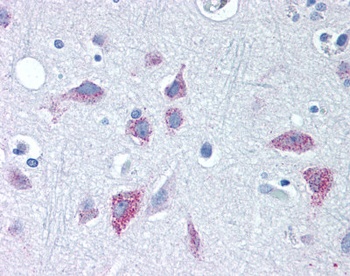 WNT8B Antibody