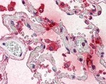 TPSAB1 Antibody