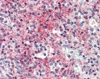 CCL5 Antibody, Monoclonal
