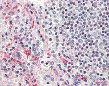 HPSE Antibody