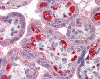 PLTP Antibody