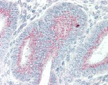 ORAI3 Antibody