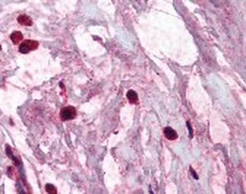 TPSAB1 Antibody