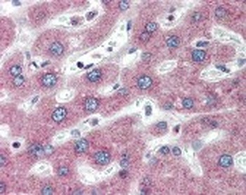 PTH1R Antibody