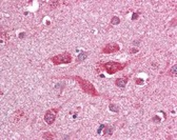 TLR8 Antibody