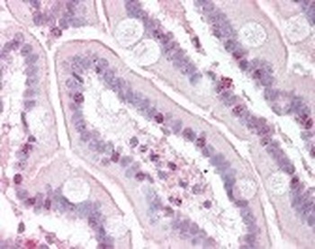 RTEL1 Antibody