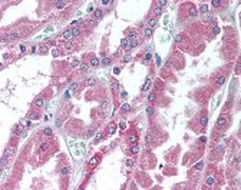 COL18A1 Antibody
