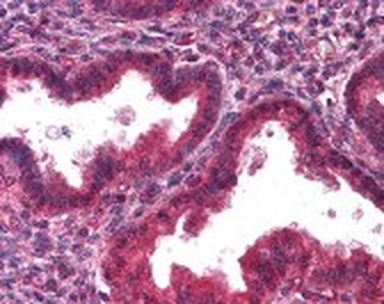 DCN Antibody