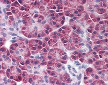 SIK2 Antibody