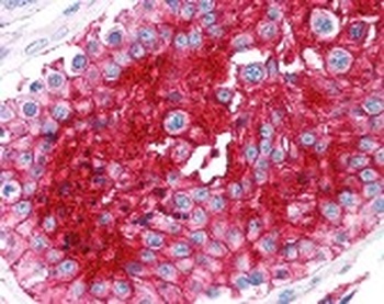 BSG Antibody
