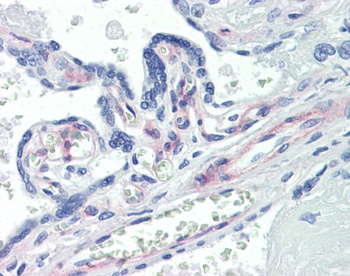 PDGFR Antibody [42G12]