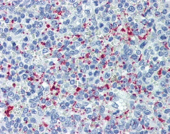 CD62P Antibody [Psel.KO.2.5]