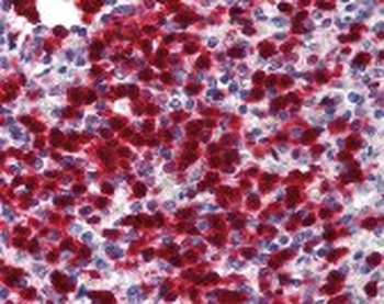 CDA Antibody