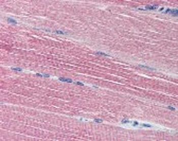 ACHE Antibody