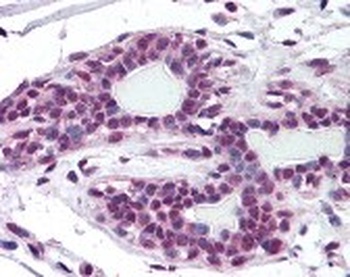 ZMYM2 Antibody