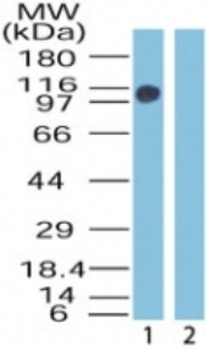 ZMYM2 Antibody