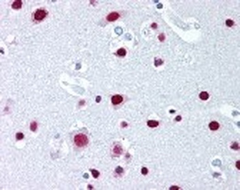 SAFB Antibody
