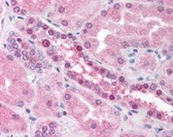 RAD54L Antibody