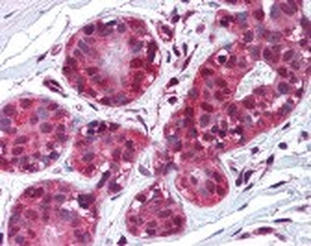 TIMP2 Antibody