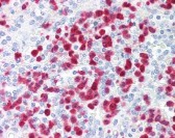 S100A8 Antibody