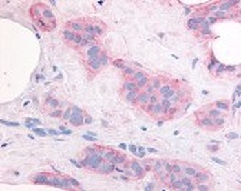 KDR Antibody