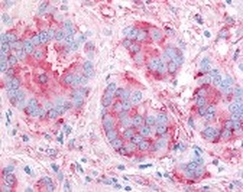 KDR Antibody