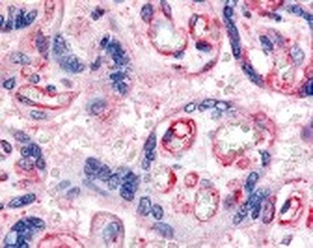 FLT1 Antibody