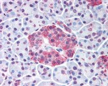 WNT10A Antibody