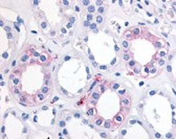 EPHX2 Antibody