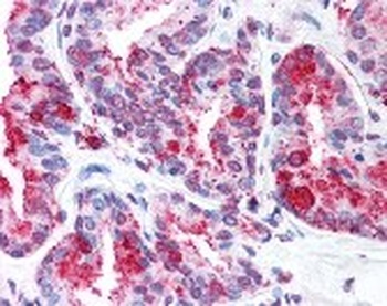 WNT5B Antibody