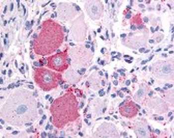 TRPV2 Antibody