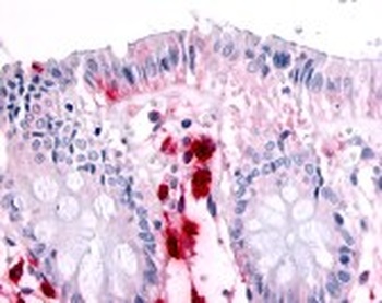 MST1R Antibody