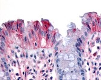MST1R Antibody