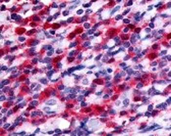 FLT3 Antibody