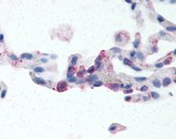 EMR2 Antibody